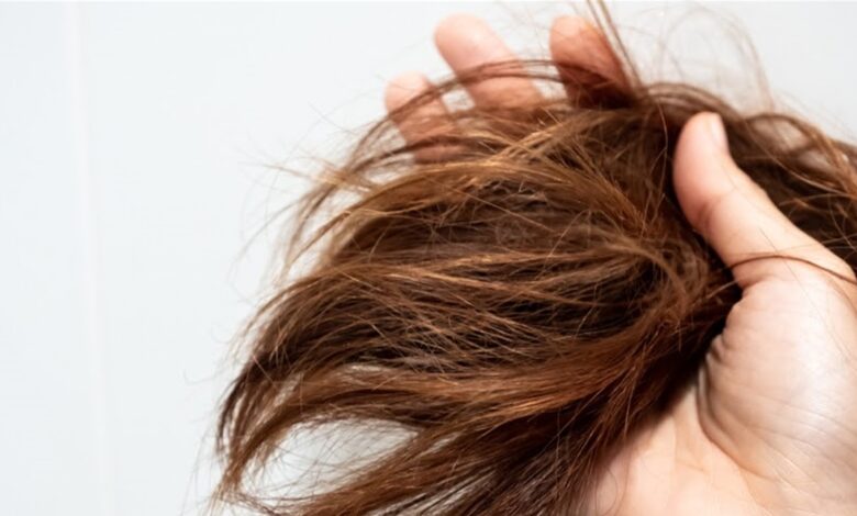 مشكلة تقصف الشعر .. ما هي الماسكات الطبيعية المناسبة؟